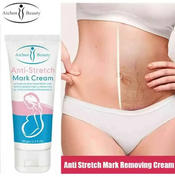 Aichun-beauty-anti-stretch-mark-cream-60g