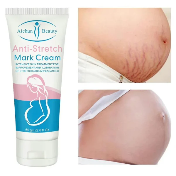 Aichun-beauty-anti-stretch-mark-cream-60g-price